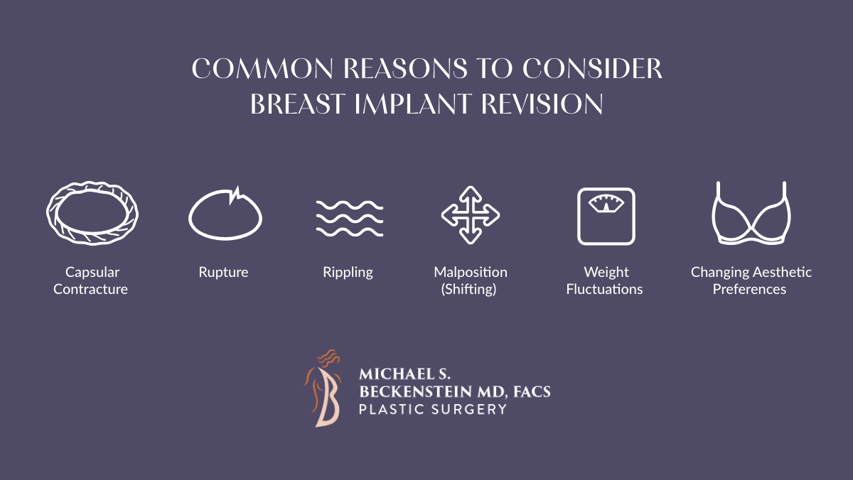 An infographic illustrating six common reasons for considering breast implant revision: Capsular Contracture, Rupture, Rippling, Malposition, Weight Fluctuations, and Changing Aesthetic Preferences, presented by Michael S. Beckenstein Plastic Surgery.