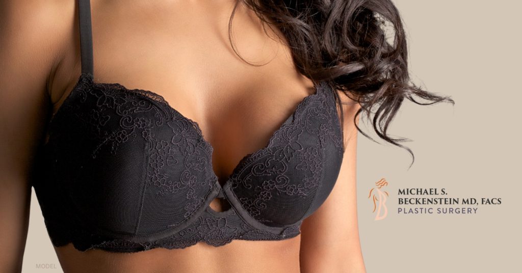 Woman in black bra (MODEL) - Michael S. Beckenstein MD, FACS Plastic Surgery logo