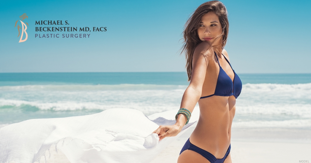 Woman post tummy tuck procedure (model)