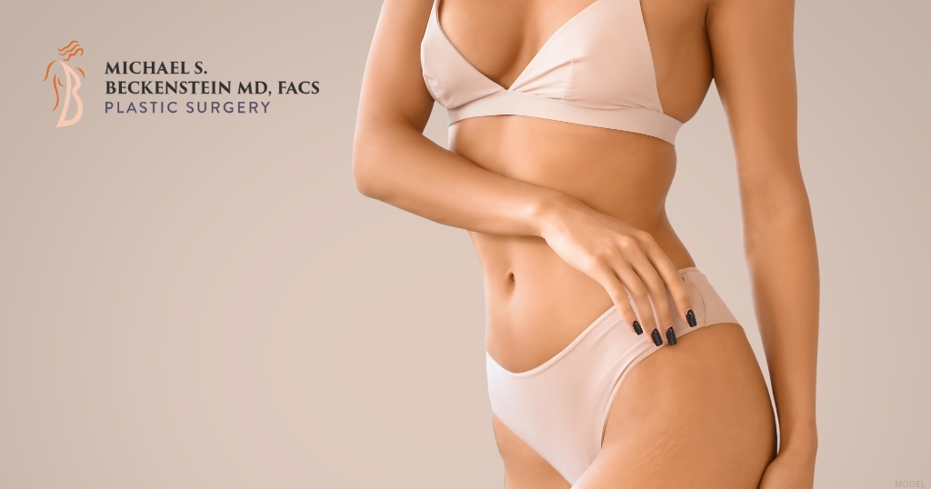 A woman in a beige bikini top stands against a beige background (model) Michael S. Beckenstein, MD Logo