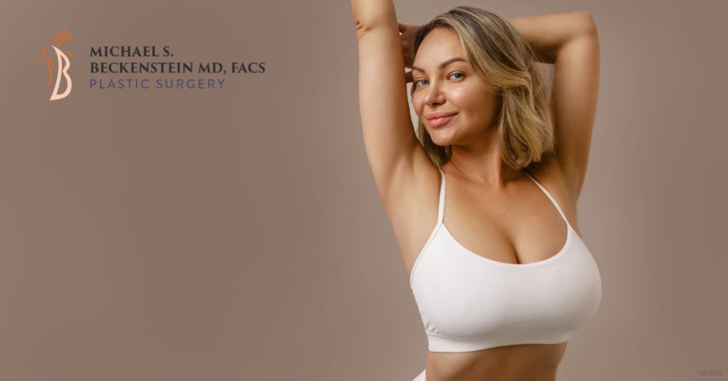 Smiling woman post breast lift procedure (model)