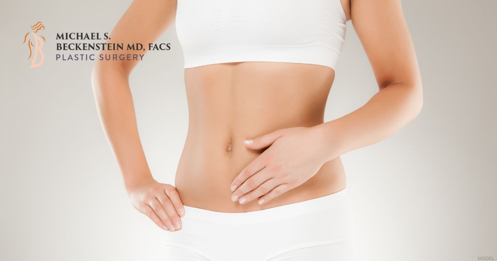 Close-up of a woman’s abdomen showing a natural-looking belly button after tummy tuck surgery (model) Michael S. Beckenstein, MD Logo.